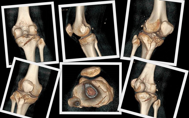 Knee collage_resized.jpg