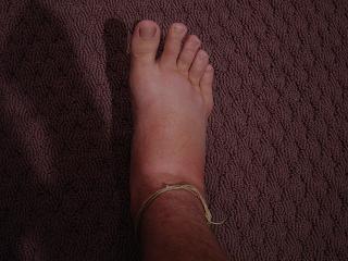 my freakin fat foot also also resized.JPG