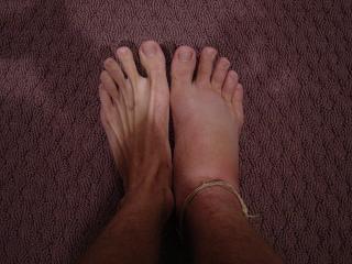 my freakin fat foot resized.JPG